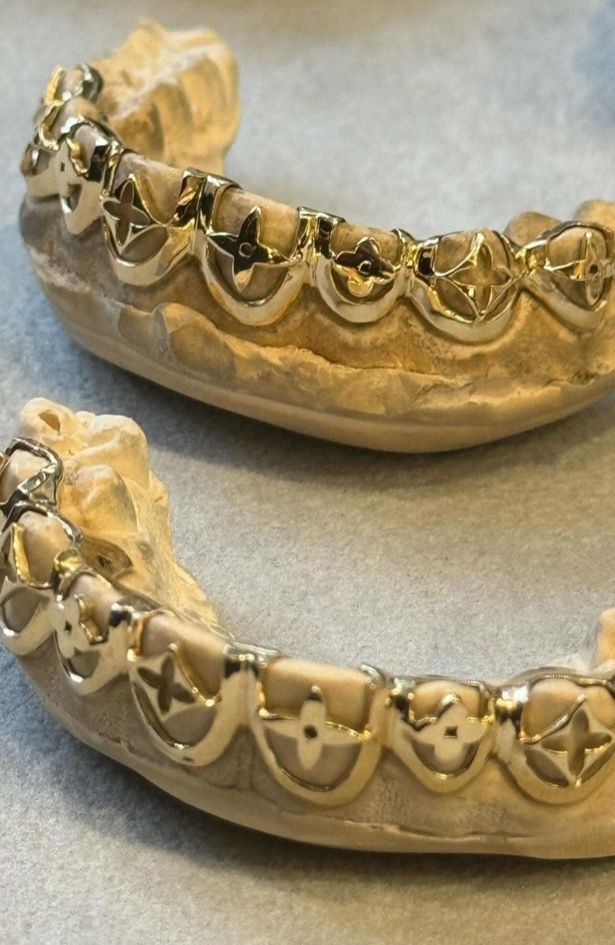 Grillz kao (ne)očekivan beauty momenat Louis Vuitton AW24 revije