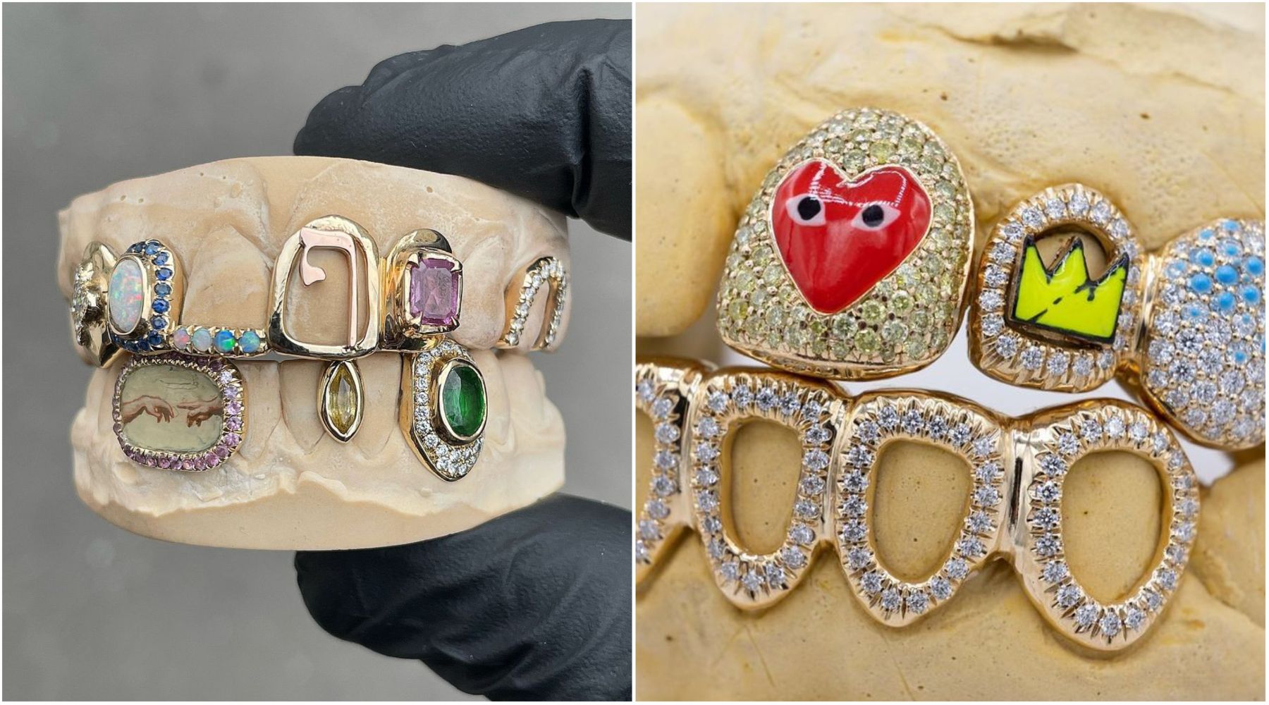 Hypebeast beauty: Grillz kao nekonvencionalni medijum umetničkog izražavanja
