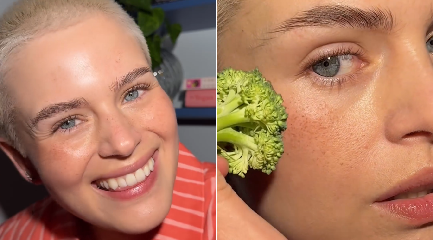 Beauty trick: Lažne pegice uz pomoć brokolija, može!